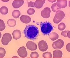 Analysis of endocannabinoid signaling elements and related proteins in lymphocytes of patients with Dravet syndrome